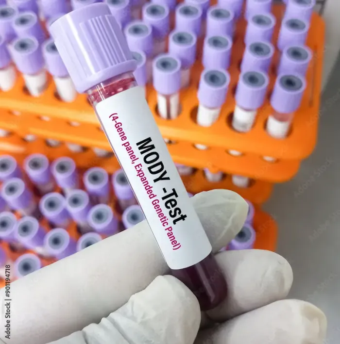 MODY Diabetes Overview and Treatment Options